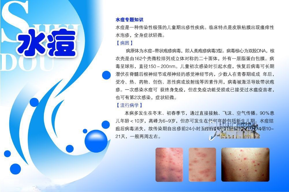 预防水痘板报展板设计图