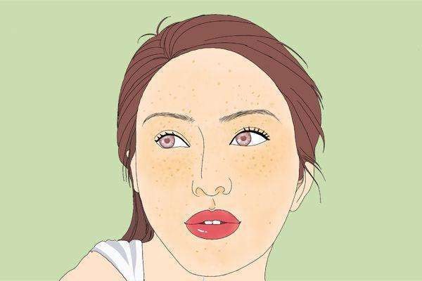 黄瓜敷脸能去黄褐斑吗 白醋洗脸可以去除黄褐斑吗 黄瓜敷脸能去黄褐斑吗 白醋洗脸可以去除黄褐斑吗