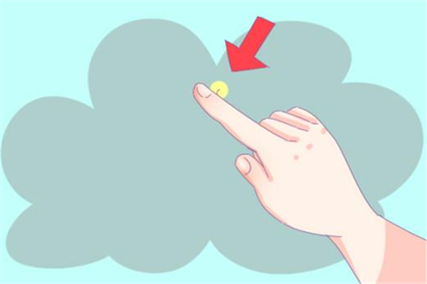 倒刺会自己掉吗 倒刺不处理会怎么样 倒刺会自己掉吗 倒刺不处理会怎么样