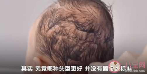 网红矫正头盔或影响婴儿发育 定型枕定型头盔有用吗 网红矫正头盔或影响婴儿发育 定型枕定型头盔有用吗