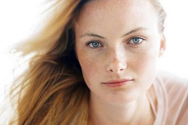 晒斑是黄褐斑的一种吗 晒斑是老年斑吗 晒斑是黄褐斑的一种吗 晒斑是老年斑吗