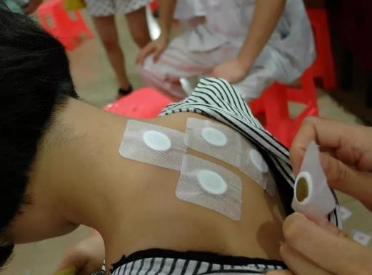 贴三伏贴后多久可以同房?三伏贴和艾灸一起做好不好