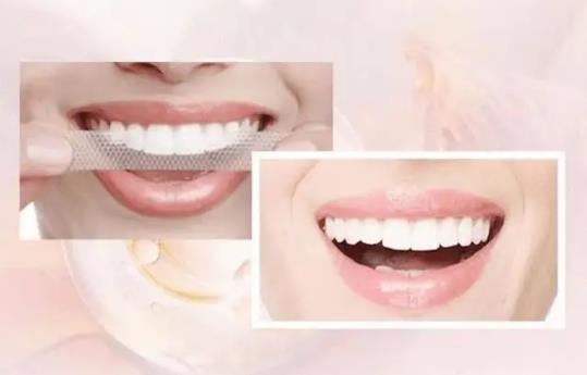 用完美白牙贴怎么清洁牙齿?贴美白牙贴有口水要吐出来吗