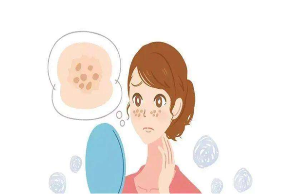 黄褐斑是怎么样形成的 黄褐斑是什么样子 黄褐斑是怎么样形成的 黄褐斑是什么样子