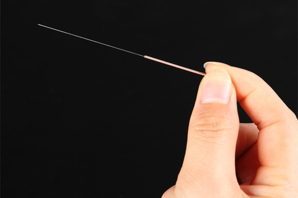 针灸要天天扎还是隔几天扎 针灸要做几次才有效果 针灸要天天扎还是隔几天扎 针灸要做几次才有效果