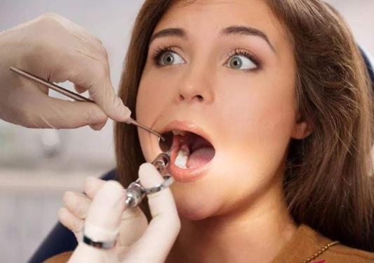 拔牙是整个连根拔起吗?拔牙是整体的还是打碎拔好