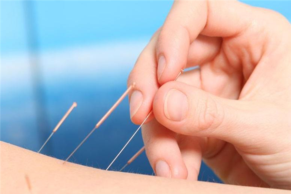 针灸后可以洗澡吗 针灸后多久可以碰水 针灸后可以洗澡吗 针灸后多久可以碰水