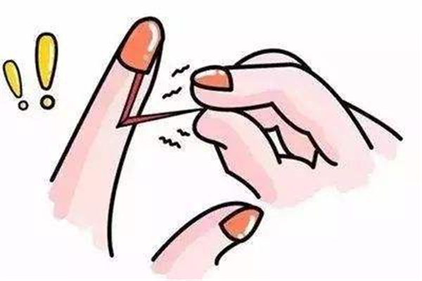 手长倒刺是什么原因造成的 手长倒刺是缺少什么维生素 手长倒刺是什么原因造成的 手长倒刺是缺少什么维生素