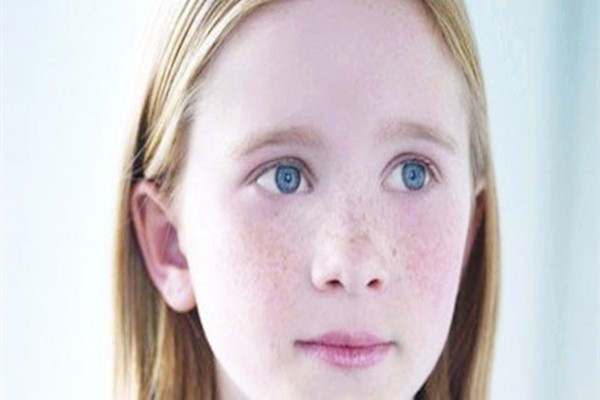 晒斑是黄褐斑的一种吗 晒斑是老年斑吗 晒斑是黄褐斑的一种吗 晒斑是老年斑吗