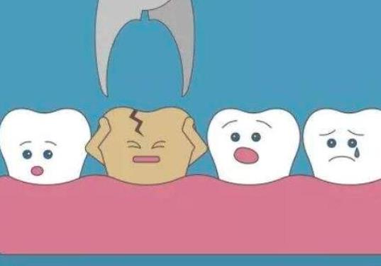 拔牙一次可以拔三颗吗?拔牙拔一侧还是拔双侧好一些