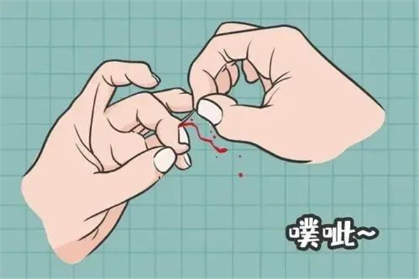 倒刺可以撕吗 倒刺拔了会怎么样 倒刺可以撕吗 倒刺拔了会怎么样