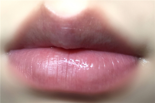 丰唇有硬块什么原因 丰唇硬块会消失吗 丰唇有硬块什么原因 丰唇硬块会消失吗