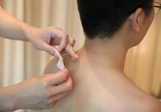 去年的三伏贴今年还可以用吗?三伏贴间隔8天可以贴吗