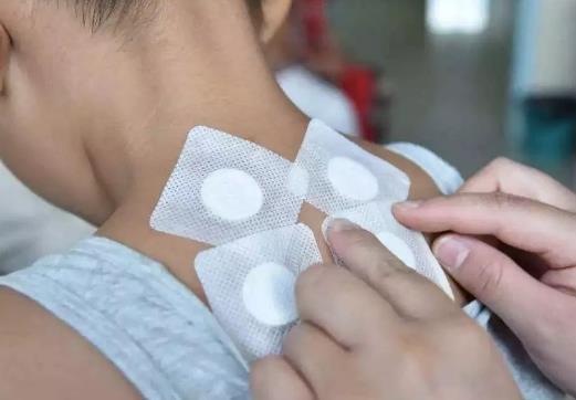 三伏贴最后一贴什么时候贴?三伏贴是隔天贴还是连续贴