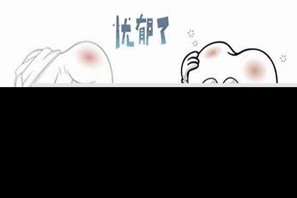 补牙是越贵越好吗 补牙最好的方式