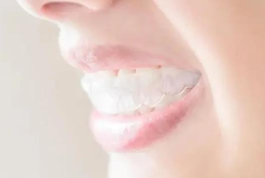 戴牙套吃饭怎么能不塞?戴牙套一直疼怎么办