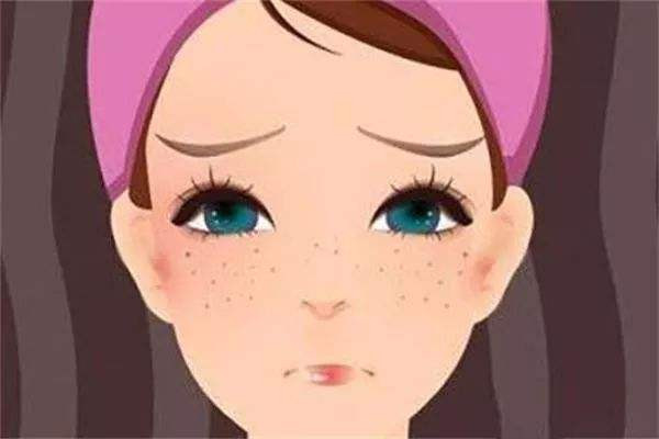 黄褐斑会不会传染 黄褐斑会不会越来越严重 黄褐斑会不会传染 黄褐斑会不会越来越严重