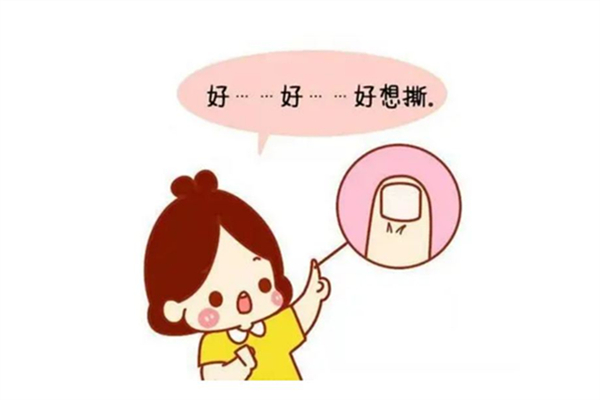 倒刺会自己掉吗 倒刺不处理会怎么样 倒刺会自己掉吗 倒刺不处理会怎么样