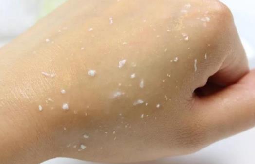 不去角质是不是用的护肤品都不会吸收 去角质素多久用一次比较好