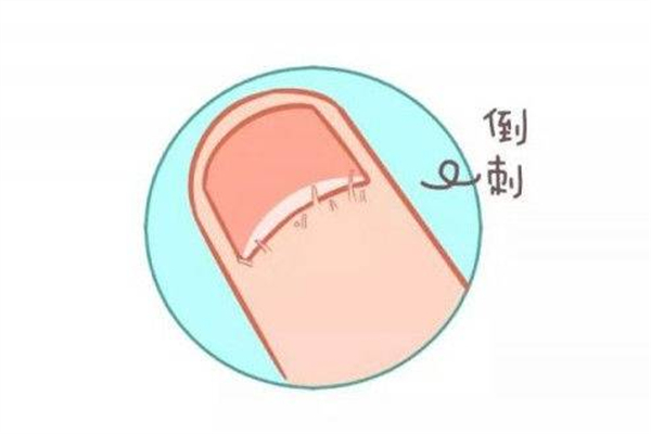 手长倒刺涂护手霜有用吗 手上倒刺涂什么比较好 手长倒刺涂护手霜有用吗 手上倒刺涂什么比较好