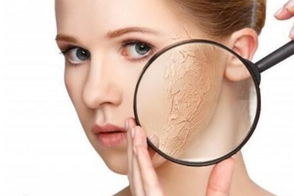 皮肤干燥脱皮严重像鱼鳞怎么办 皮肤干燥起皮像鱼鳞是怎么回事 皮肤干燥脱皮严重像鱼鳞怎么办 皮肤干燥起皮像鱼鳞是怎么回事