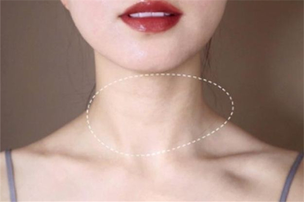 颈纹嗨体注射一次多少钱 颈纹嗨体是什么 颈纹嗨体注射一次多少钱 颈纹嗨体是什么