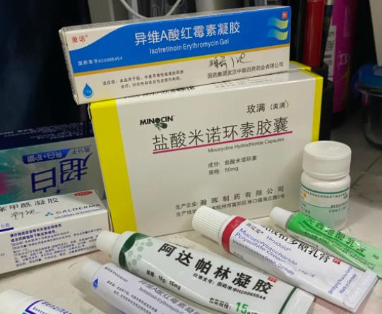 米诺环素吃了脑子会变笨吗?米诺环素一停药毛囊炎就复发怎么办