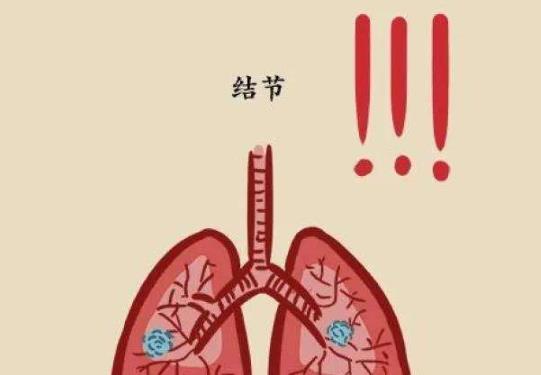 单位体检一半人都有肺结节吗?10个人有9个人有肺结节是真的吗