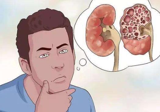 降尿酸可以喝什么茶?尿酸过高会引起什么病