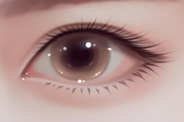 开眼角后多久可以洗脸 开眼角后多久能戴隐形眼镜 开眼角后多久可以洗脸 开眼角后多久能戴隐形眼镜