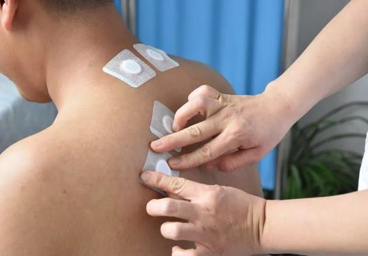 贴三伏贴后多久可以同房?三伏贴和艾灸一起做好不好