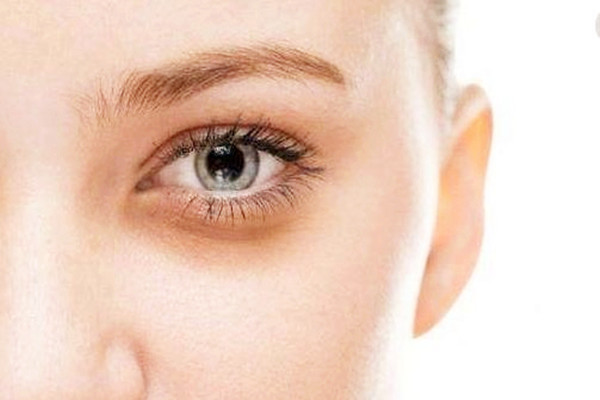 黑眼圈是天生的吗 黑眼圈会自己消失吗 黑眼圈是天生的吗 黑眼圈会自己消失吗