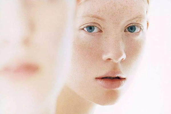 晒斑是黄褐斑的一种吗 晒斑是老年斑吗 晒斑是黄褐斑的一种吗 晒斑是老年斑吗