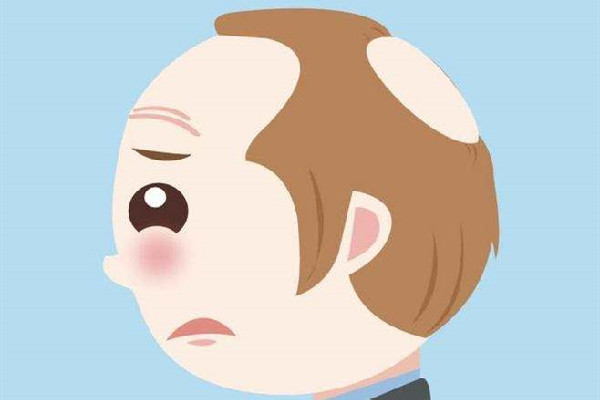 植发用的是哪里的毛囊 植发会不会有什么副作用 植发用的是哪里的毛囊 植发会不会有什么副作用