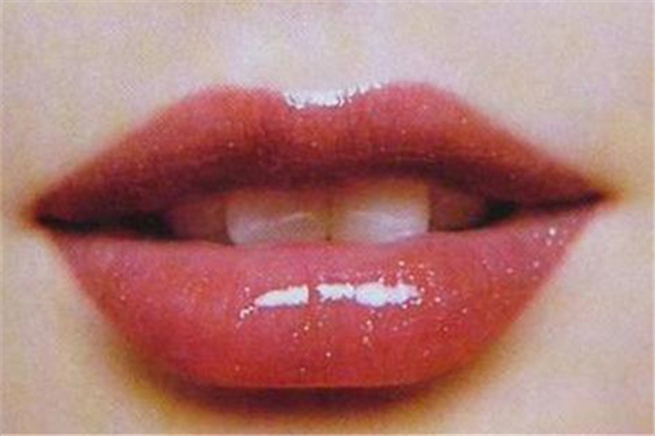 丰唇后多久消肿 丰唇后要冰敷吗 丰唇后多久消肿 丰唇后要冰敷吗