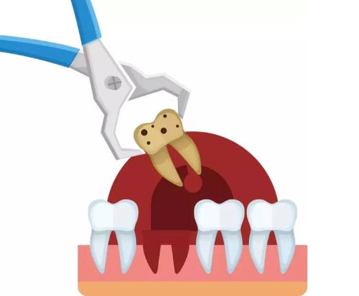 拔牙后冷敷和热敷分别敷哪个位置?拔牙后冷敷用湿毛巾还是干毛巾包裹