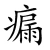 瘺
